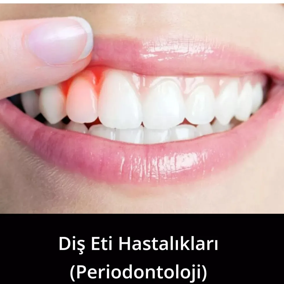 First slide